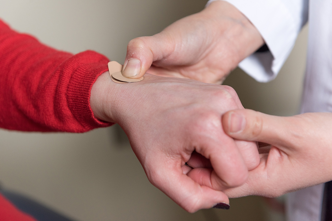 A closeup of a doctor's hand pressing a quarter-size microneedle patch onto a the back of a patient's hand